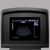 Аппараты УЗИ + УЗИ сканер Med-Mos CMS600B3